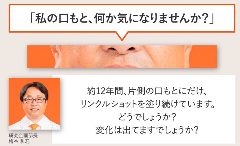 ポーラ　リンクルショット　ほうれい線　効果